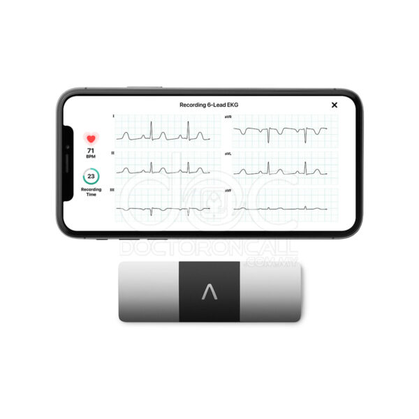AliveCor KardiaMobile 6L